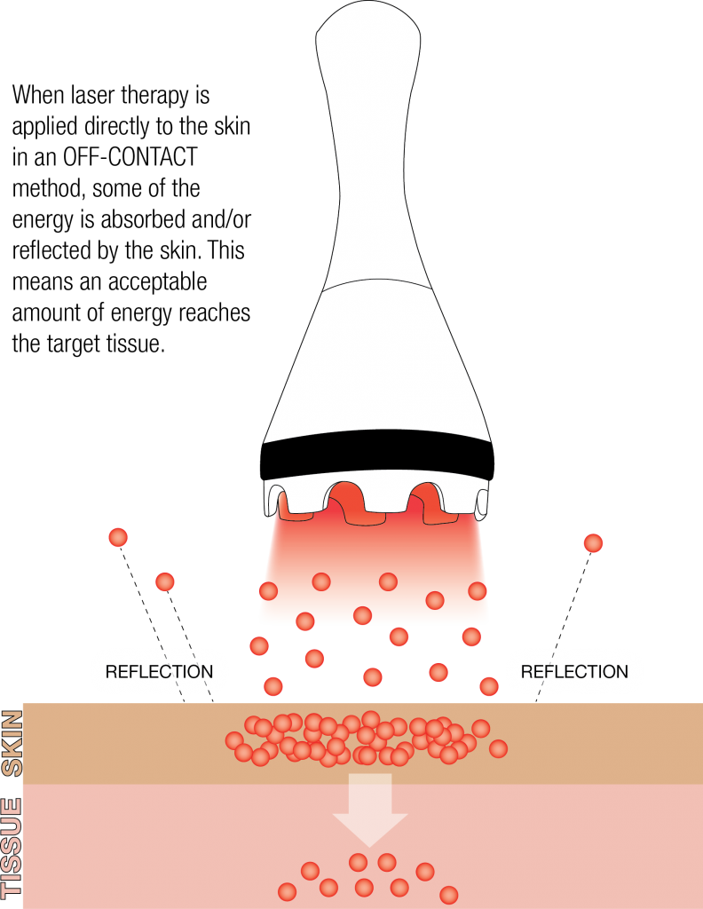 class 5 laser therapy